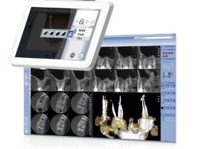 Clinique-dentaire-scan-3D