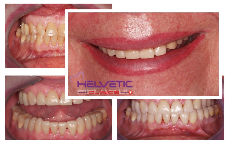 Helvetic Dental Clinics Hôtel