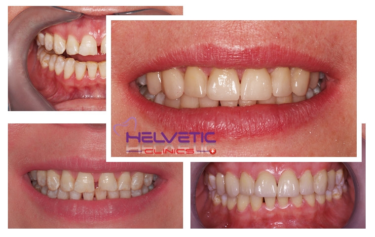 pourquoi choisissez Helvetic Clinics