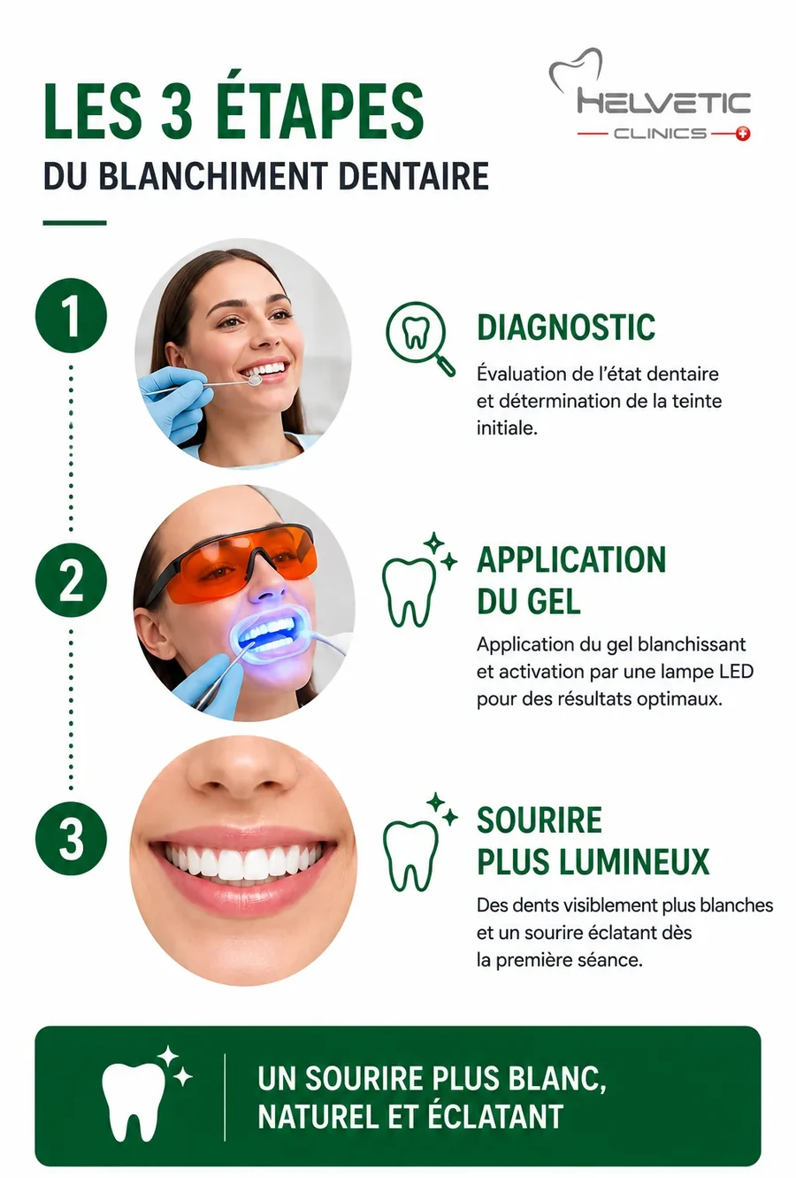 etapes blanchiment dentaire professionnel helvetic clinics budapest