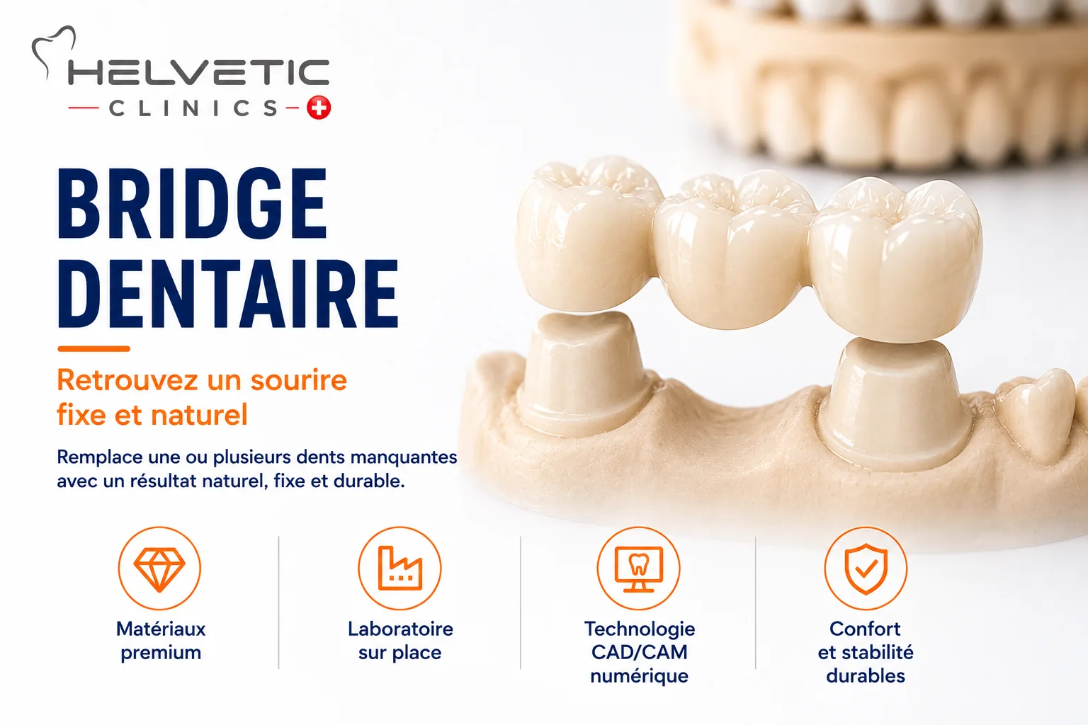 Prothèses dentaires en Hongrie : couronnes, bridges, prothèses ...