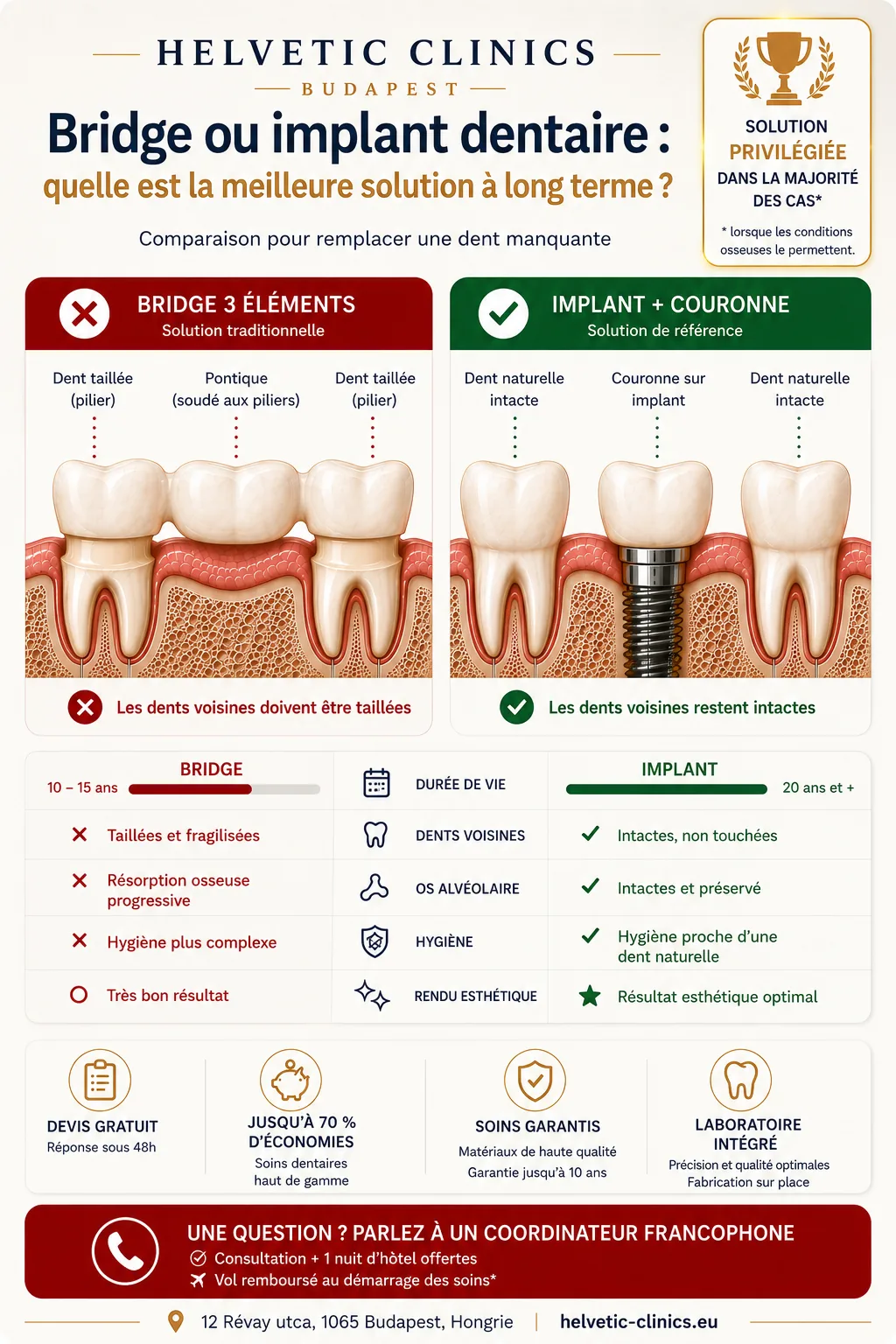 Comparatif bridge dentaire ou implant dentaire chez Helvetic Clinics à Budapest : le bridge nécessite de tailler les dents adjacentes tandis que l'implant préserve les dents naturelles et l'os alvéolaire.